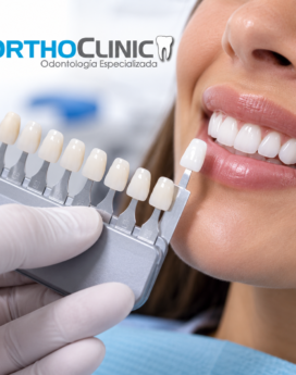 Consulta especializada para tu diseño de sonrisa