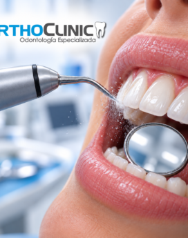 Limpieza dental ultrasónica GRATIS